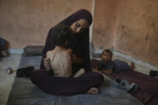 Severely malnourished toddler Yazan sits with his mother, Naima Abu Ful, in Gaza City.